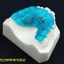 스타치과기공소 이미지