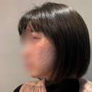 대구 중구 피부과 쥬베룩 스킨부스터 내돈내산 후기 &gt; 대구 하이린의원 방문하다!
