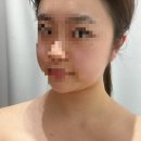 행복한 자수 이야기 | [과천 수기관리] 20년 경력 원장님의 '피부이야기'에서 수기관리로 갓벽 윤곽 찾은 후기