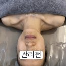 선 에스테딕 네이버블로그