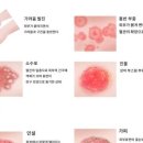 세제한의원 네이버블로그