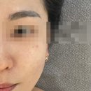 수얀스킨케어