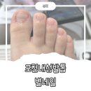 별에서온 네일 | 포천내성발톱 별네일에서 꼼꼼하게 관리받고 온 후기