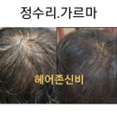 헤어존 신비