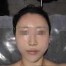 수성구피부관리 홍조끼 잡티 속건조 잡는 물톡스 멋진인생에스테틱황금점 후기