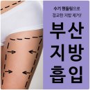 광안카클리닉 | 부산지방흡입비용 고민말고 여기서 상담받으세요!