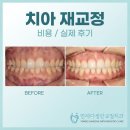 서울다정치과의원 | 치아 재교정 비용 및 실제 후기로 알아보는 재교정치과 선택 팁