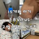 바이러스 | 아기 EBV 바이러스 입원 후기 | 고열 5일, 발진부터 간수치까지