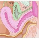 [질성형]기혼여성이 고민하는 요실금! 질성형으로 확실히 잡자! 이미지