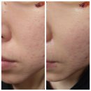 단(DAN) | 홈케어 가성비 갈바닉마사지기 단DAN 블리스틱 초소형 휴대 가능한 뷰티기기