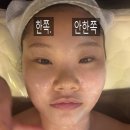 훼미리프라자빌딩 앞 | 안양 평촌 윤곽관리 이경연뷰티테라피 | 안 아파서 꿀잠 잔 작은 얼굴 수기테라피 후기