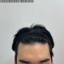 세븐일레븐 부산양정중앙점 | 부산 양정 가일컷의 완성, 남자 헤어라인 두피커버 후회없는 선택 (+내돈내산 솔직후기)