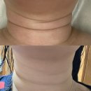 리지에스테틱 | [분당/정자] 정자에스테틱 정자관리맛집 리지에스테틱 후기