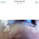 아이스킨 | -8탄 눈가 탄력 시리즈-내 돈 내산 아이리쥬란 + 눈가 스킨보톡스 리얼 후기(각각 다른 병원 비교)