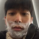 남자 레이저 제모 1회차 후기