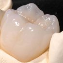 골드크라운 이미지