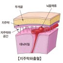 하에