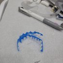 수원탑치과의원 | 수원 탑 치과 미백 1회차 후기