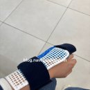 블리스타워 서천 | 킥보드 타다 넘어져 골절상 용인이엠365의원 이용후기