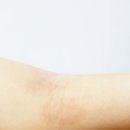 지바이오 | [미라클 모이스쳐 밸런싱 크림] 아토피 피부염 개선 실제 4주간 사용 후기...