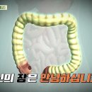 [닥터의 경고, 대장질환] 서구식 식습관, 과식! 당신의 장은 안녕하십니까? 대장 내시경 중 발견되는 대장 용종! ... 이미지