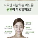 위례별한의원 이미지