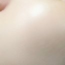 피부힐링 이미지