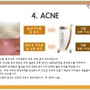 트리플엘 이미지