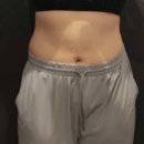 소래약국 | 알파cd 효능 부작용 알고는 먹기