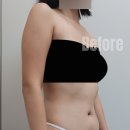 청담슬림의원 | 청담슬림의원 팔지흡 리얼후기!