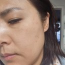 강릉인셀덤 | 강릉인셀덤 서지우 ^^ 인셀덤 후기