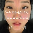 언니네가게 | 여주 피부관리 페이스왁싱 추천 언니네피부가게 재방문 후기