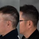 디블랙 | 김천탈모커버 김천 SMP 디블랙아카데미 솔직 체험 후기