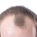 그로우메디 이미지