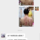 두원프라자 | [정령체형관리] 승모근순삭 1회케어 전후비교사진
