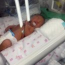 한국지엠개금바로서비스 | NICU 입원 후기 신생아 중환자실 미숙아 의료비 지원 태아보험청구