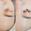 [진해피부관리] 진해 석동 피부샵 켈리스파 물방울리프팅 대박이네
