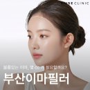 이마 | 부산 이마필러 후기 용량 효과 상담 기준 제대로 알아야 합니다
