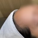 퀸헤어라인 이미지