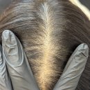 6 | 김포정수리문신 6개월후기 리터치변화