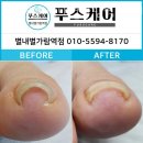남양주네일샵 푸스케어 별내별가람역점&amp;네일 인 주차문의