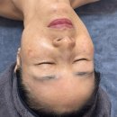 (유)보금 | 기미, 검버섯 제거 부모님 효도선물은 보금뷰티에서!(feat.내돈내산)