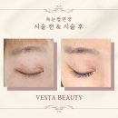 베스타뷰티 | 베스타뷰티 속눈썹 LED디자인연장 후기 / 비포 에프터