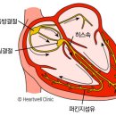 심전도(EKG/ECG) PQRST 파를 읽는방법.(이해) 이미지