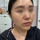 북가좌수약국 | 북가좌동 피부관리 등관리 트러블관리 6회차 재방문 후기!