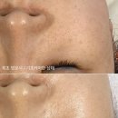 이진쵸이스