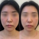 (주)솜바이오 | 경주 피부관리 용황동 에스테틱) 더맑음스킨케어 모공, 윤곽 맞춤 관리 후기
