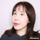 튠업 | 을지로피부과 벨로리프트 & 폴라젠튠업 내돈내산 솔직후기