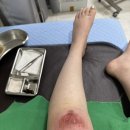 서일우정형외과의원 네이버블로그