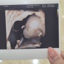[임신 기록] 성별/각도법/태담/임당 검사&amp;정밀 초음파 검사후기 연산 위대한탄생 산부인과(2)